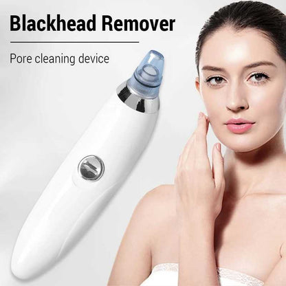 Electric Blackhead Remover — Deep Pore Vacuum Cleanser | Clearer, Smoother Skin