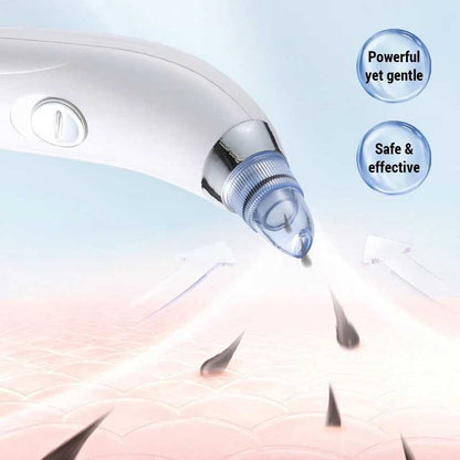 Electric Blackhead Remover — Deep Pore Vacuum Cleanser | Clearer, Smoother Skin