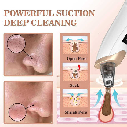 5-in-1 Electric Blackhead Remover Pore Vacuum